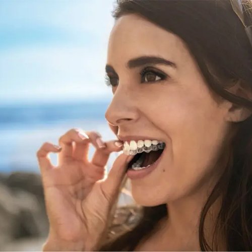 Trattamento Invisalign